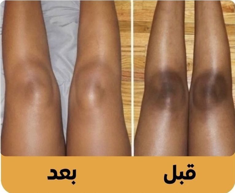 SNOW BLEACH كريم التبييض