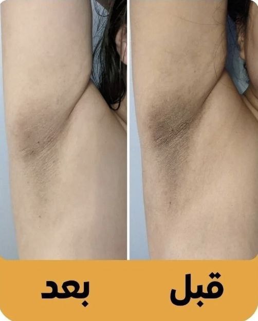 SNOW BLEACH كريم التبييض