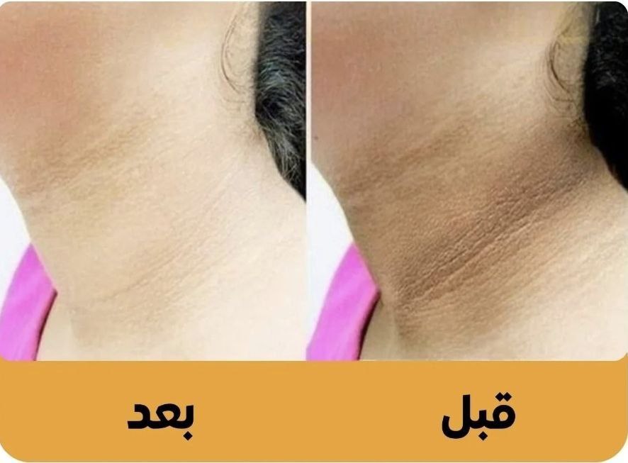 SNOW BLEACH كريم التبييض